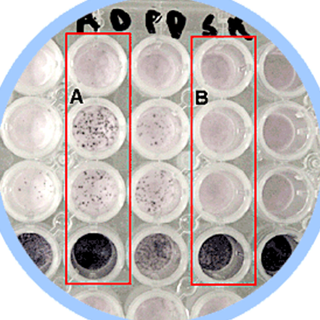 ELISPOT assay